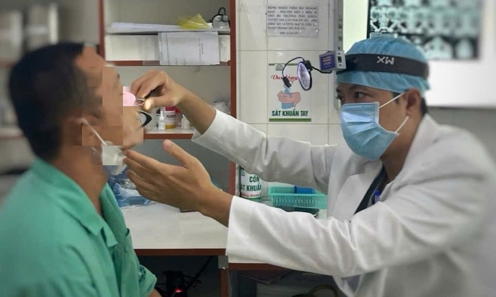 Phẫu thuật lấy chiếc đũa bị “bỏ quên” trong mũi bệnh nhân