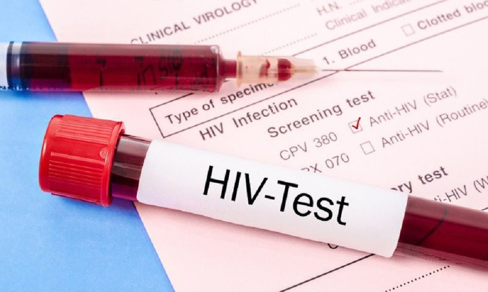 Điều kiện xác định người bị phơi nhiễm, nhiễm HIV do tai nạn rủi ro nghề nghiệp